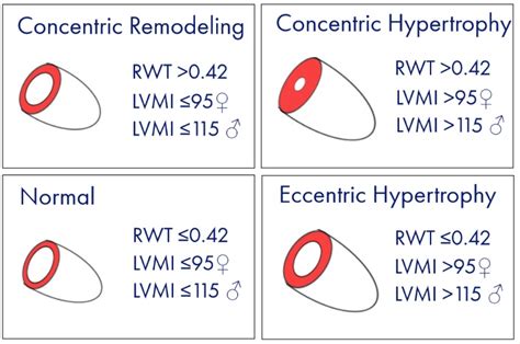 Left ventricular mass index .